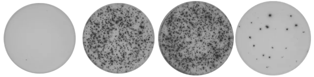 ELISpot (Enzyme-Linked Immunospot